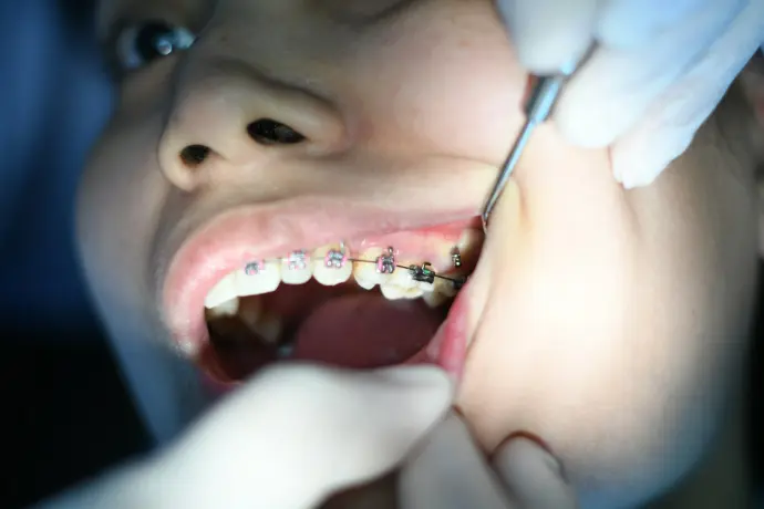 Orthodontie